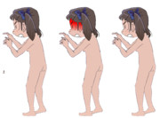 裸一貫無職ちゃん