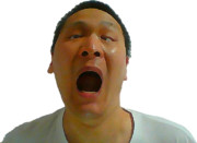 僕の顔がブクブクすぎる件