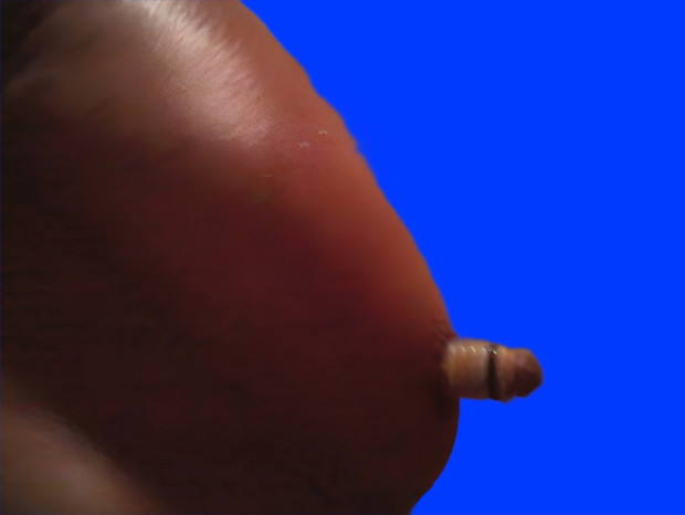 寄生虫BB