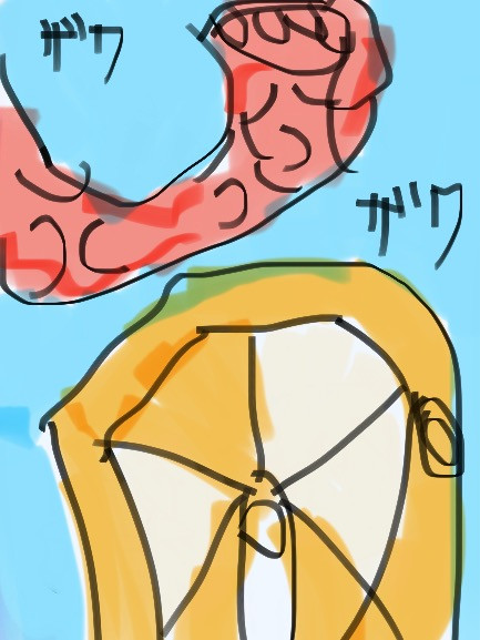 エラー
