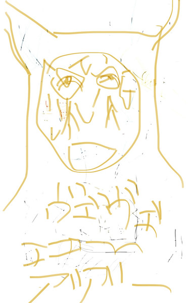 腹痛