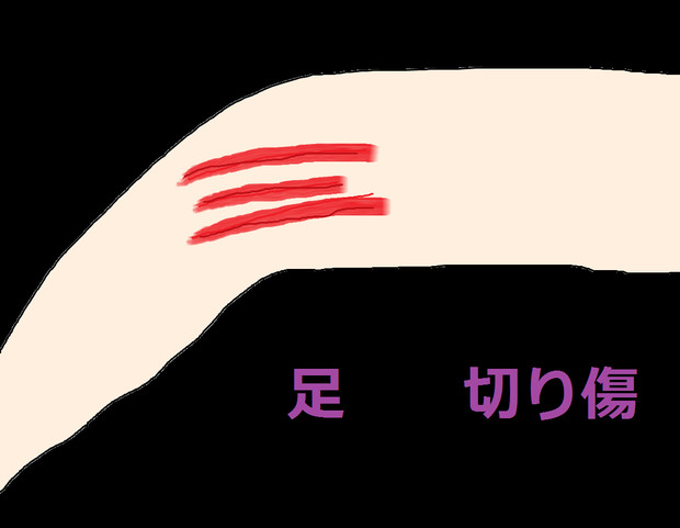 いたた 謎の傷 篠崎ﾖｼｴ さんのイラスト ニコニコ静画 イラスト