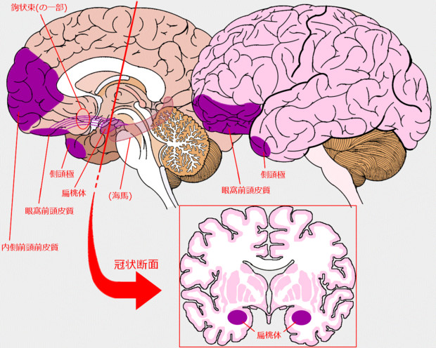 サイコパスの脳において異状が見られる部位（紫色）